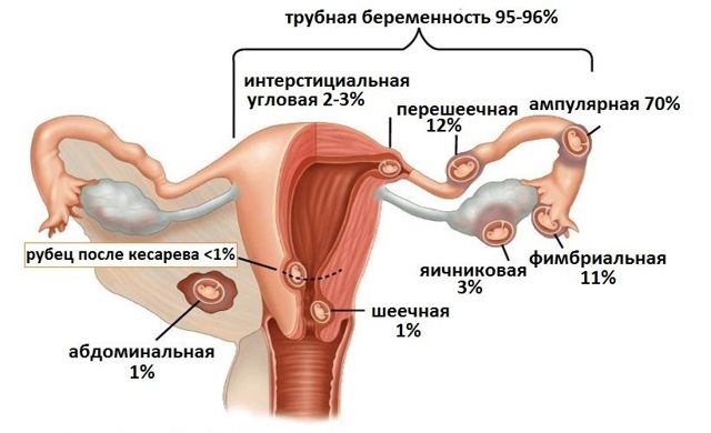 Развитие плода на 8 неделе беременности (17 фото): что происходит с малышом, размеры ребенка и ощущения, как выглядит малыш на 8 акушерской неделе