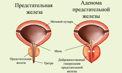 Частое мочеиспускание у мужчин с болью и без боли – причины и методы профилактики. Лечение частого мочеиспускания у мужчин - Автор Екатерина Данилова