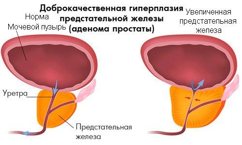 Урорек - 10 отзывов, цена от 512 руб., инструкция по применению