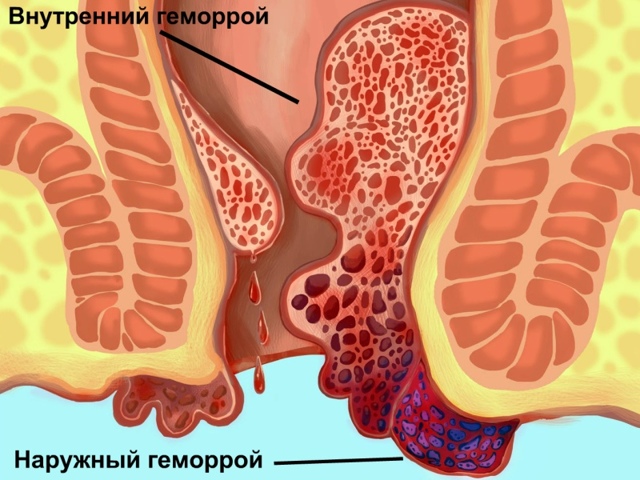 МАЗЬ ПОСТЕРИЗАН - инструкция по применению, цена, отзывы и аналоги