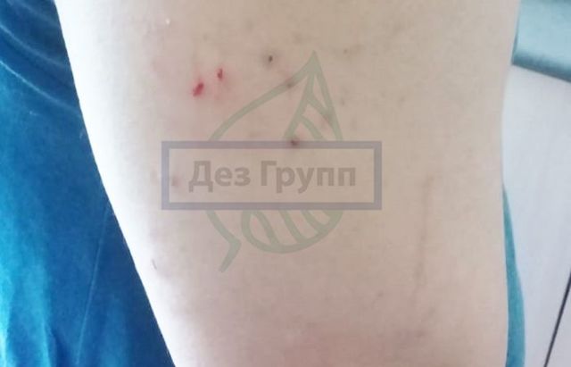 Какие последствия может иметь укус клеща у человека
