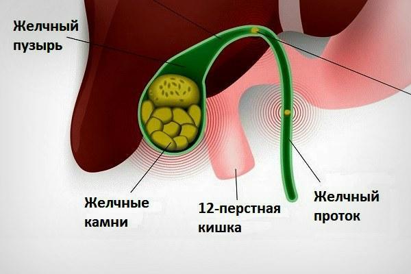 Желтые белки глаз: причины симптомы и лечение