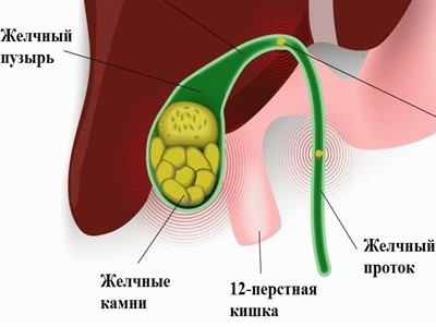 Горечь во рту по утрам: причины появления и лечение