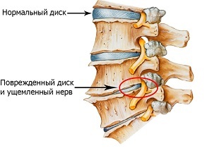 ПИРОКСИКАМ - инструкция по применению, цена, отзывы и аналоги