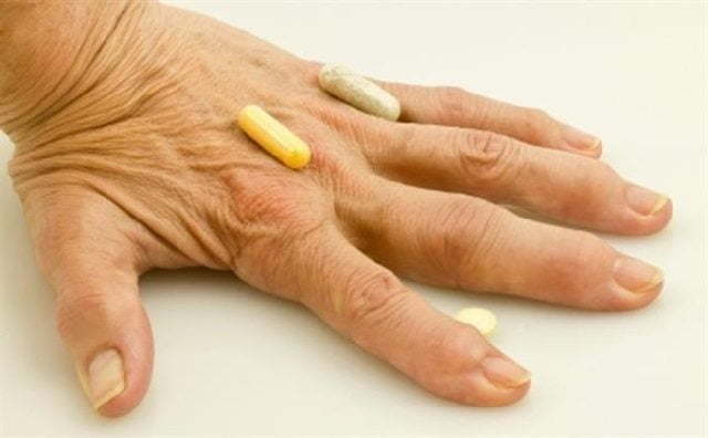 Метотрексат при ревматоидном артрите — Суставы