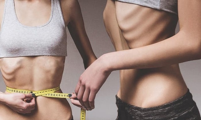 Анорексия - anorexia - ВСЁ ОБ АНОРЕКСИИ