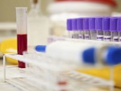 Иммуноглобулин Е: повышен, у ребенка, что значит, что показывает, общий, норма, расшифровка, что это