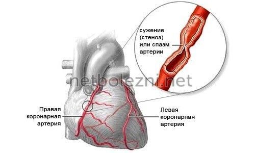 Предуктал и Предуктал MB: инструкция по применению, цена, отзывы кардиологов, дешевые аналоги