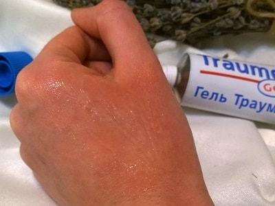 Гель Траумель С (Traumeel S): инструкция по применению, состав препарата