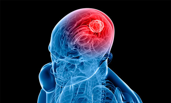 Клещевой энцефалит: диагностика, симптомы и лечение заболевания