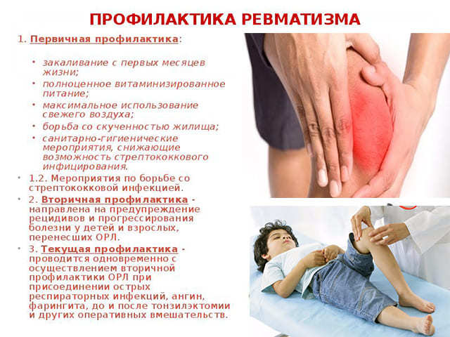 Ревматизм суставов - симптомы и лечение