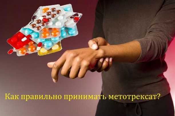 Метотрексат при ревматоидном артрите — Суставы