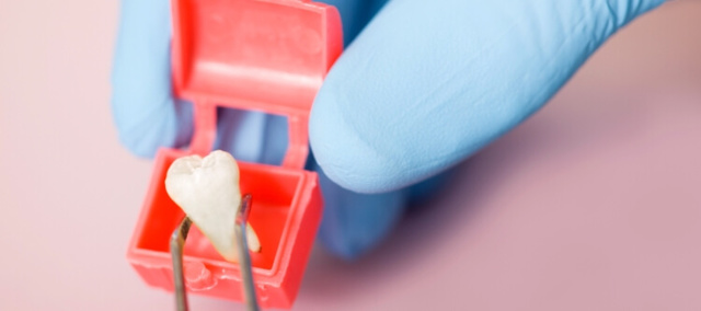 Зуб мудрости - как выглядит: описание, особенности, сроки прорезывания