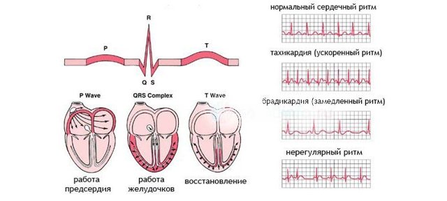Синусовая тахиаритмия у детей на экг: что это такое?
