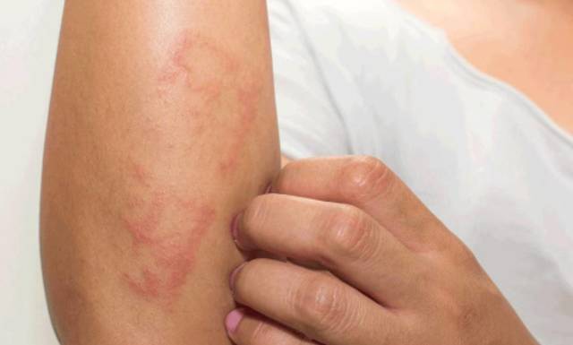 Клималанин - инструкция по применению, аналоги и отзывы, сколько стоит?