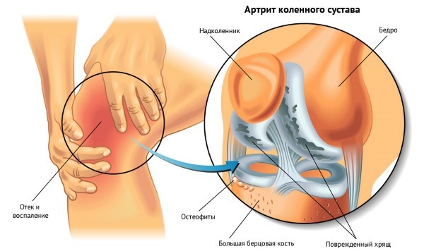 Биопин - 2 отзыва, инструкция по применению