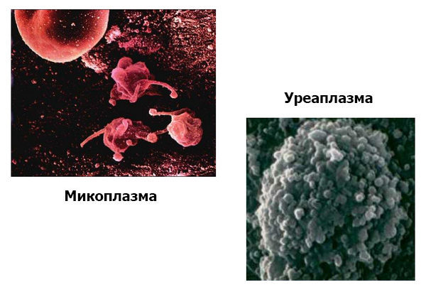Уреаплазмоз у мужчин – симптомы, лечение