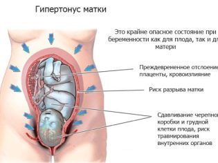 Свечи с папаверином: инструкция по применению при беременности и отзывы