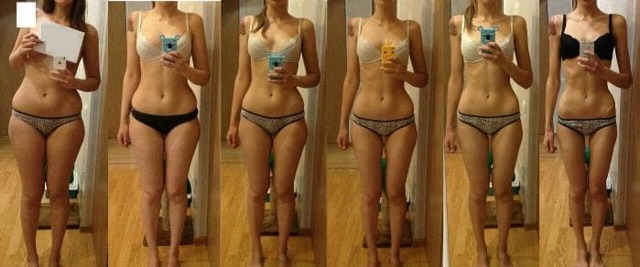 Анорексия - anorexia - ВСЁ ОБ АНОРЕКСИИ
