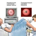 Кольпоскопия шейки матки: что это такое в гинекологии, как ее делают, подготовка к исследованию