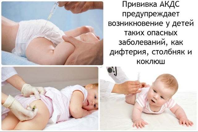 Коклюш у детей: симптомы и лечение