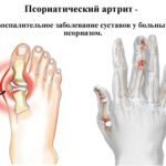 Инструкция по применению Мазь Гэвкамен - показания