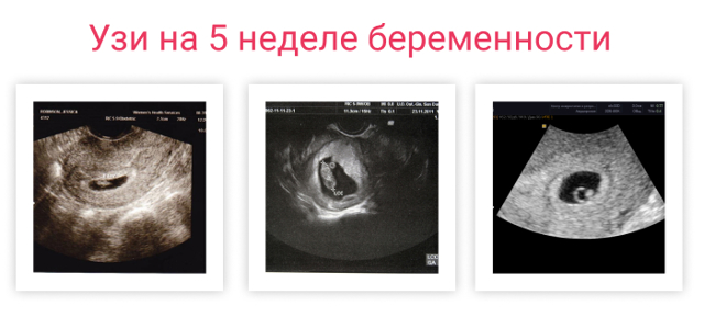 Пятая неделя беременности