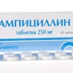 Ревматизм суставов - симптомы и лечение