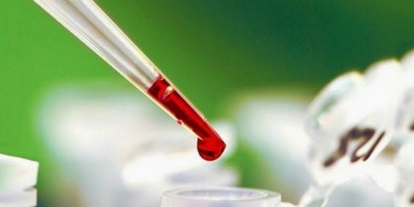 Свертываемость крови по сухареву норма у детей - Лечение гипертонии