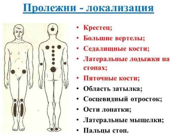 Инструкция по применению мази Офломелид - показания