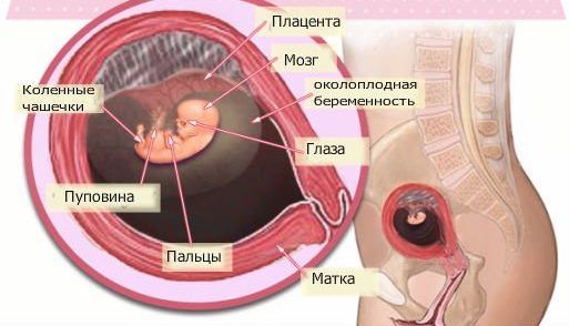 Развитие плода на 8 неделе беременности (17 фото): что происходит с малышом, размеры ребенка и ощущения, как выглядит малыш на 8 акушерской неделе
