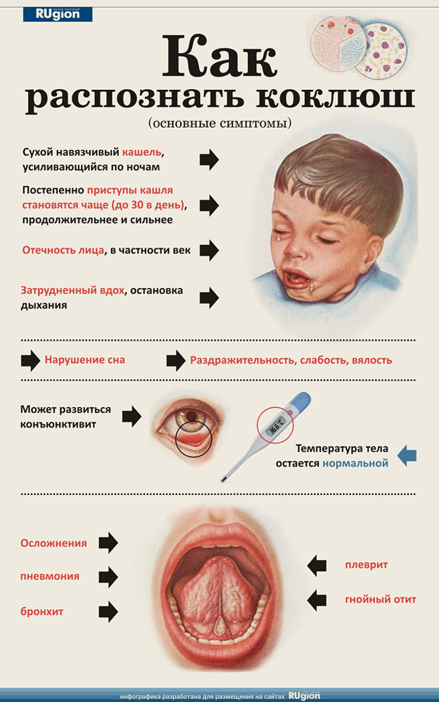 Коклюш у детей: симптомы и лечение