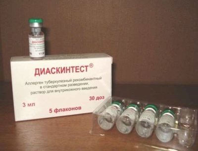 Диаскинтест результаты у детей: норма, положительный, отрицательный