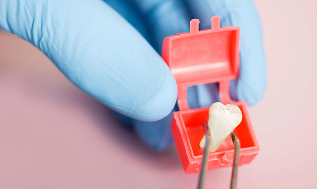 Зуб мудрости - как выглядит: описание, особенности, сроки прорезывания