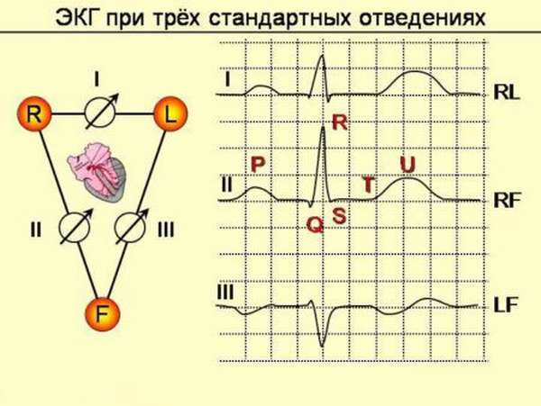 Рубцовые изменения — E-Cardio
