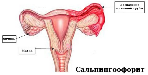 Болит низ живота у женщины: причины и лечение