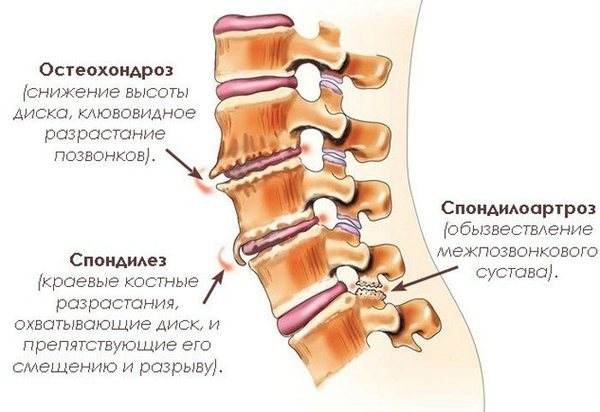 Головная боль в затылке: причины и лечение
