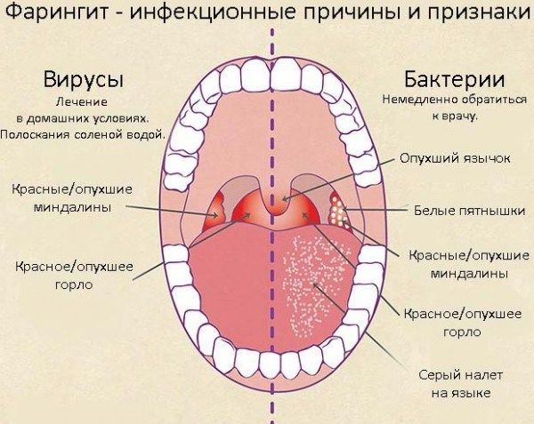 Гексализ - таблетки для рассасывания, инструкция по применению