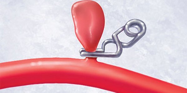 Основные симптомы аневризмы сосудов головного мозга