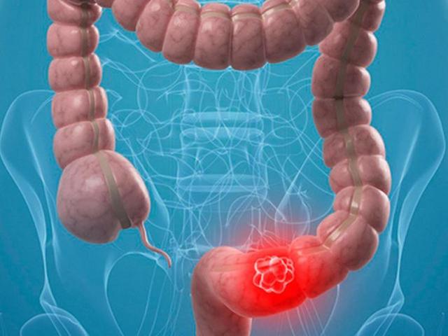 Метилурацил свечи: инструкция по применению и для чего он нужен, цена, отзывы, аналоги