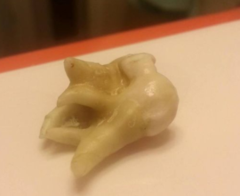 Зуб мудрости - как выглядит: описание, особенности, сроки прорезывания