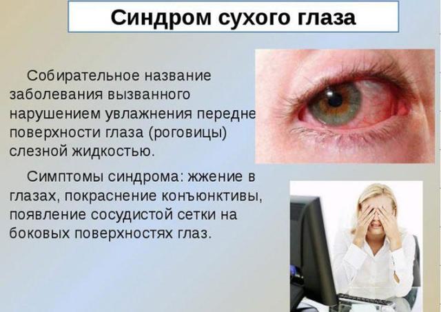 Ощущение песка в глазах, жжение и сухость: причины и лечение каплями