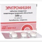 Ревматизм суставов - симптомы и лечение