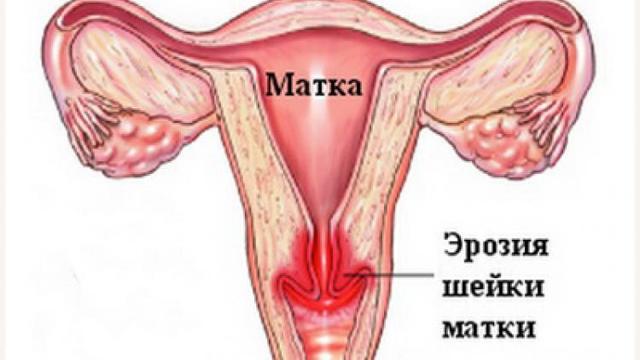 Шестая неделя беременности