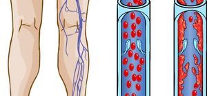 Климонорм (отзывы): инструкция по применению, аналоги, противопоказания