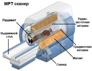 Аневризма аорты Брюшной полости: особенности заболевания и лечение