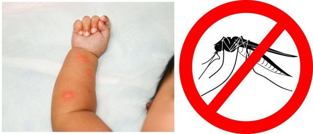 Чем снять зуд от укуса комара - обзор доступных средств