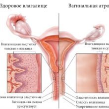Триожиналь - 6 отзывов, цена от 566 руб., инструкция по применению