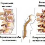 Инструкция по применению Мазь Гэвкамен - показания