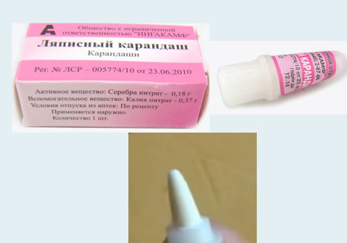 Ляписный карандаш от папиллом, инструкция по применению и отзывы